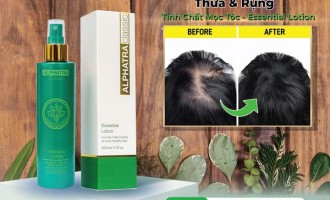 Giải Pháp Hoàn Hảo Cho Tóc Thưa & Rụng Với Tinh chất mọc tóc - ESSENTIAL LOTION