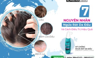 7 Nguyên Nhân Ngứa Rát Da Đầu Và Cách Điều Trị Hiệu Quả