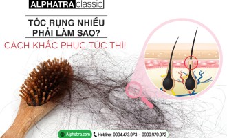 TÓC RỤNG NHIỀU PHẢI LÀM SAO? CÁCH KHẮC PHỤC TỨC THÌ!